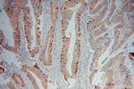 CBR3 Antibody in Immunohistochemistry (Paraffin) (IHC (P))