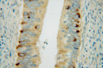 CBR3 Antibody in Immunohistochemistry (Paraffin) (IHC (P))