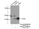 NSFL1C Antibody in Immunoprecipitation (IP)