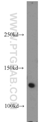 RNF40 Antibody in Western Blot (WB)