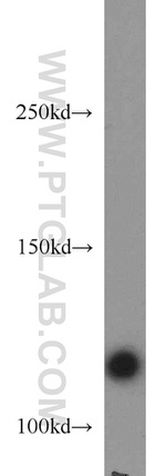 RNF40 Antibody in Western Blot (WB)