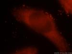 ICA1L Antibody in Immunocytochemistry (ICC/IF)