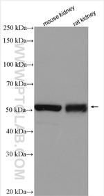 GABRD Antibody in Western Blot (WB)