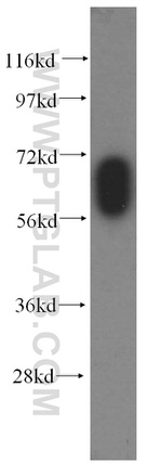 GABRD Antibody in Western Blot (WB)