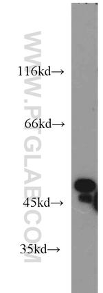 Carboxypeptidase A2 Antibody in Western Blot (WB)