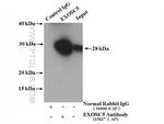 EXOSC5 Antibody in Immunoprecipitation (IP)