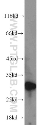 EXOSC5 Antibody in Western Blot (WB)