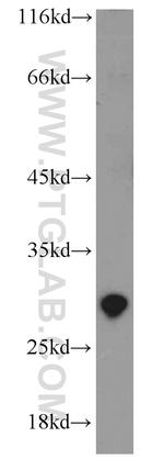 EXOSC5 Antibody in Western Blot (WB)