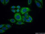 ACOT2 Antibody in Immunocytochemistry (ICC/IF)