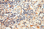 ACOT2 Antibody in Immunohistochemistry (Paraffin) (IHC (P))