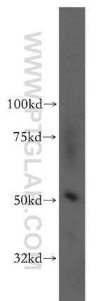 ADPGK Antibody in Western Blot (WB)