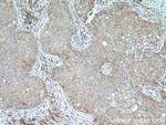 DUS3L Antibody in Immunohistochemistry (Paraffin) (IHC (P))