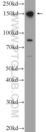 POM121 Antibody in Western Blot (WB)