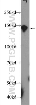 POM121 Antibody in Western Blot (WB)