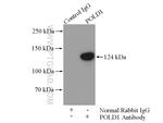 POLD1 Antibody in Immunoprecipitation (IP)