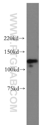 POLD1 Antibody in Western Blot (WB)