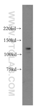 POLD1 Antibody in Western Blot (WB)