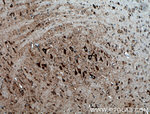 PDK2 Antibody in Immunohistochemistry (Paraffin) (IHC (P))