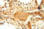 PDK2 Antibody in Immunohistochemistry (Paraffin) (IHC (P))