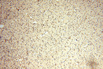 PDK2 Antibody in Immunohistochemistry (Paraffin) (IHC (P))