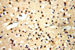 PDK2 Antibody in Immunohistochemistry (Paraffin) (IHC (P))