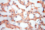 PDK2 Antibody in Immunohistochemistry (Paraffin) (IHC (P))