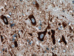 PDK2 Antibody in Immunohistochemistry (Paraffin) (IHC (P))