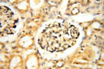 PDK2 Antibody in Immunohistochemistry (Paraffin) (IHC (P))