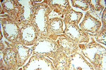 PDK2 Antibody in Immunohistochemistry (Paraffin) (IHC (P))