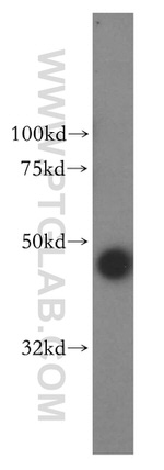 PDK2 Antibody in Western Blot (WB)