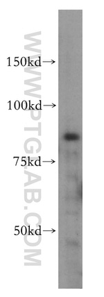 IKBKB Antibody in Western Blot (WB)