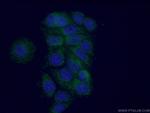 MTO1 Antibody in Immunocytochemistry (ICC/IF)