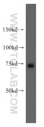 MTO1 Antibody in Western Blot (WB)