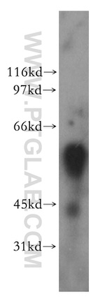 XPNPEP3 Antibody in Western Blot (WB)