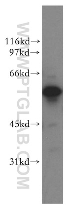 XPNPEP3 Antibody in Western Blot (WB)