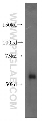 XPNPEP3 Antibody in Western Blot (WB)