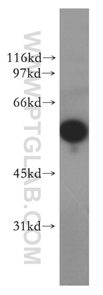 XPNPEP3 Antibody in Western Blot (WB)