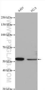 XPNPEP3 Antibody in Western Blot (WB)