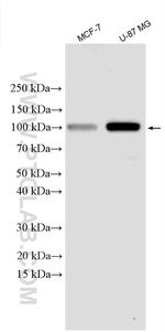 HK1 Antibody in Western Blot (WB)