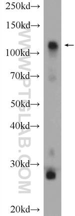 HK1 Antibody in Western Blot (WB)