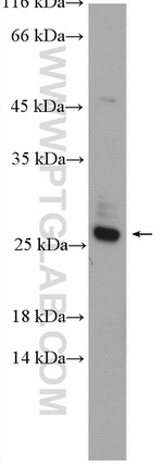 RAB14 Antibody in Western Blot (WB)