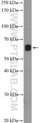 PHF1 Antibody in Western Blot (WB)