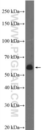 PHF1 Antibody in Western Blot (WB)