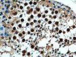 NRIP3 Antibody in Immunohistochemistry (Paraffin) (IHC (P))