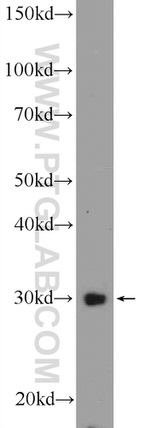 NRIP3 Antibody in Western Blot (WB)