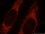 SYNJ2BP Antibody in Immunocytochemistry (ICC/IF)