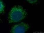 SYNJ2BP Antibody in Immunocytochemistry (ICC/IF)