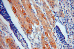 SYNJ2BP Antibody in Immunohistochemistry (Paraffin) (IHC (P))