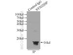 SYNJ2BP Antibody in Immunoprecipitation (IP)