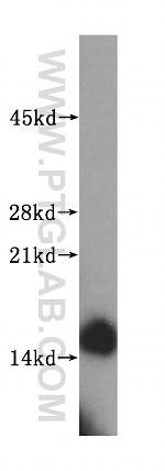 SYNJ2BP Antibody in Western Blot (WB)